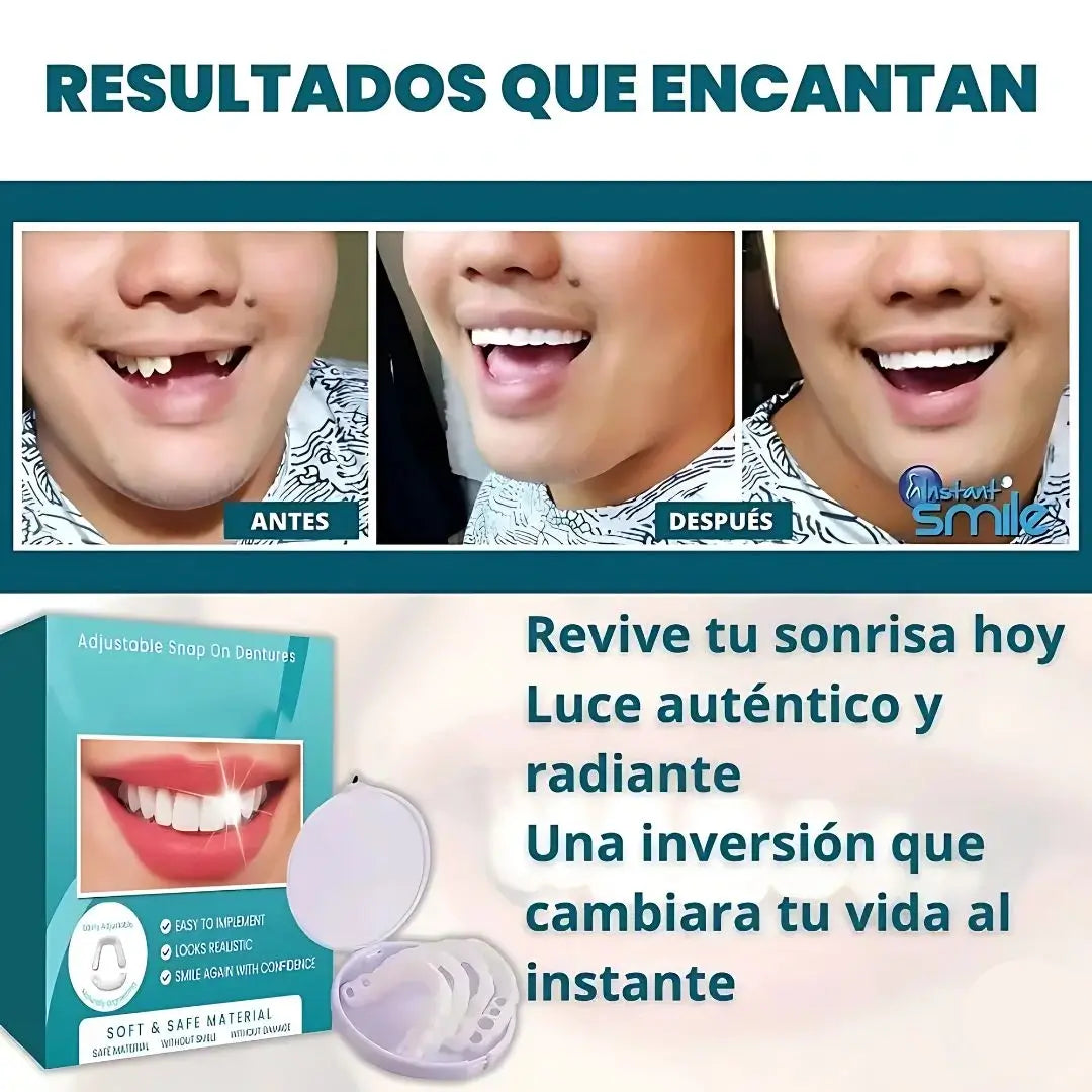 Smile Pro®| Sonrisa perfecta al instante, ¡Adiós inseguridad!