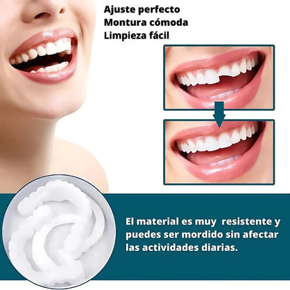 Smile Pro®| Sonrisa perfecta al instante, ¡Adiós inseguridad!